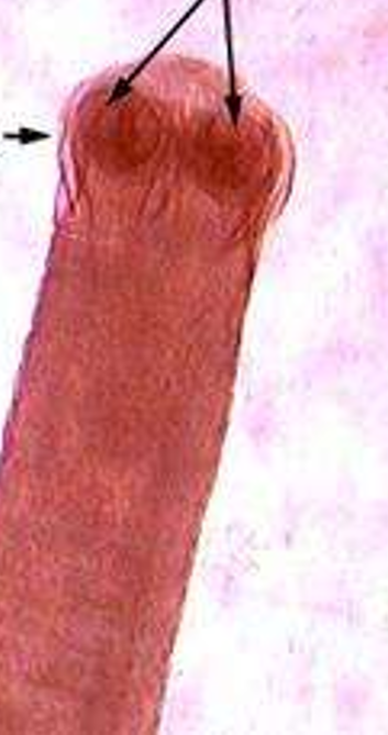 <p>spp</p><p>arrows</p>