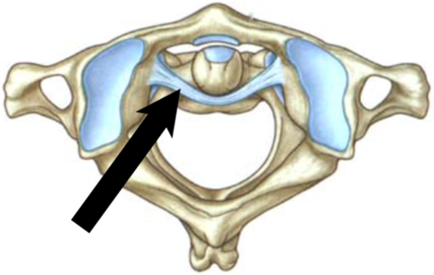 <p>attaches to the lateral masses of C1 to hold the dens in place</p>
