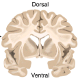 <p>divides the brain into dorsal and ventral sections</p>