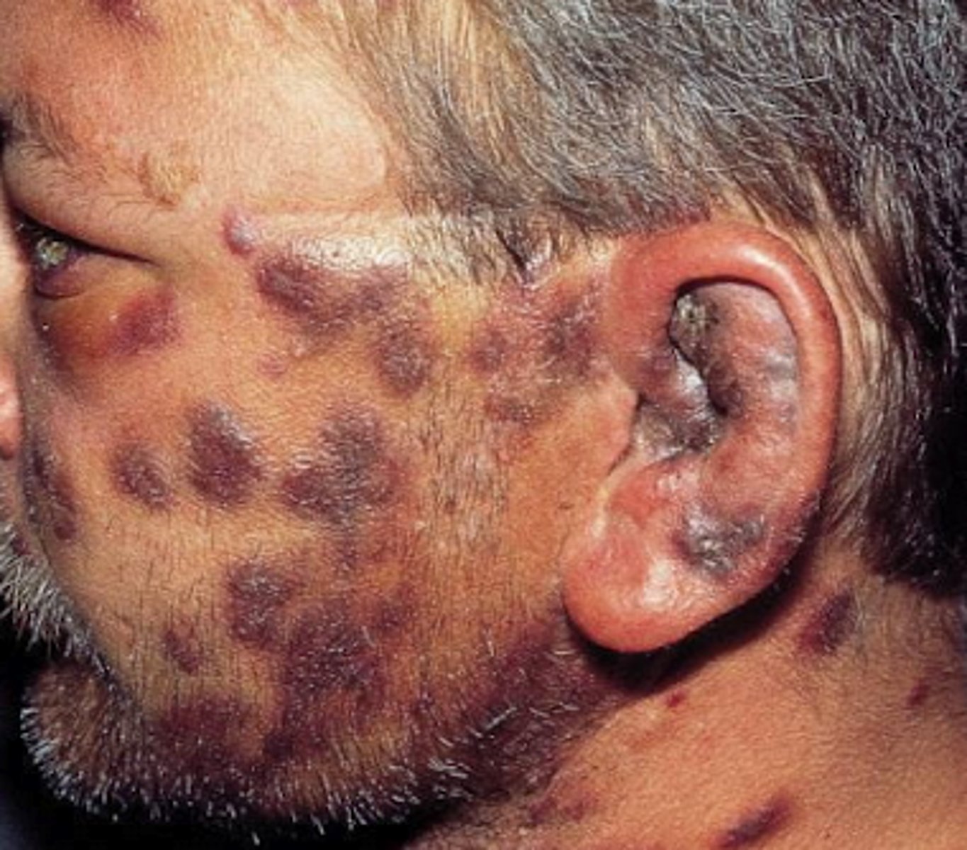 <p>What is the diagnosis?</p>