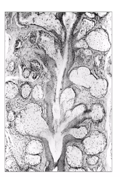 <p>meibomian gland will several alveoli emptying into a single duct&nbsp;</p>