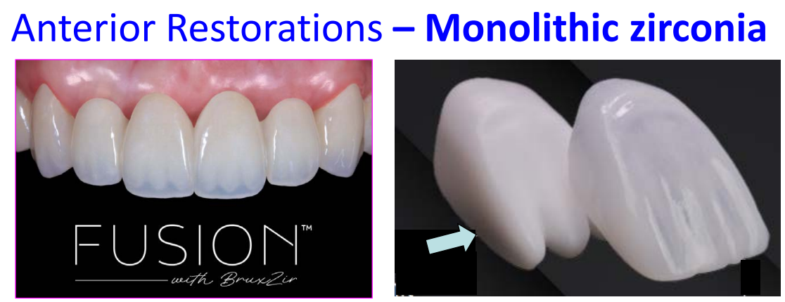 <p>monolithic zirconia characteristics </p>