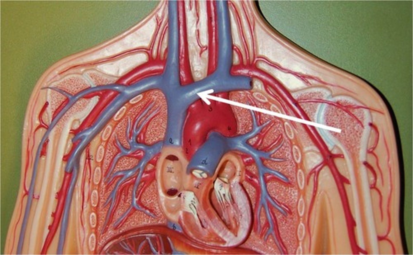 <p>These veins carry blood from the cephalic, subclavian, and jugular veins to the cranial vena cava.</p>