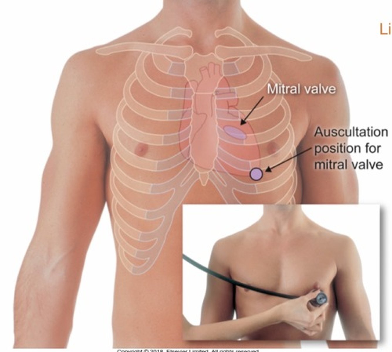 <p>5th ICS, mid clavicular line</p>