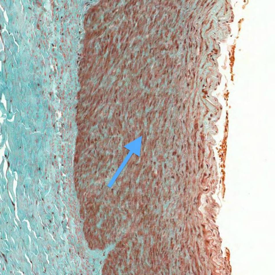 <p><span><span>Smooth muscle in the tunica media</span></span></p>