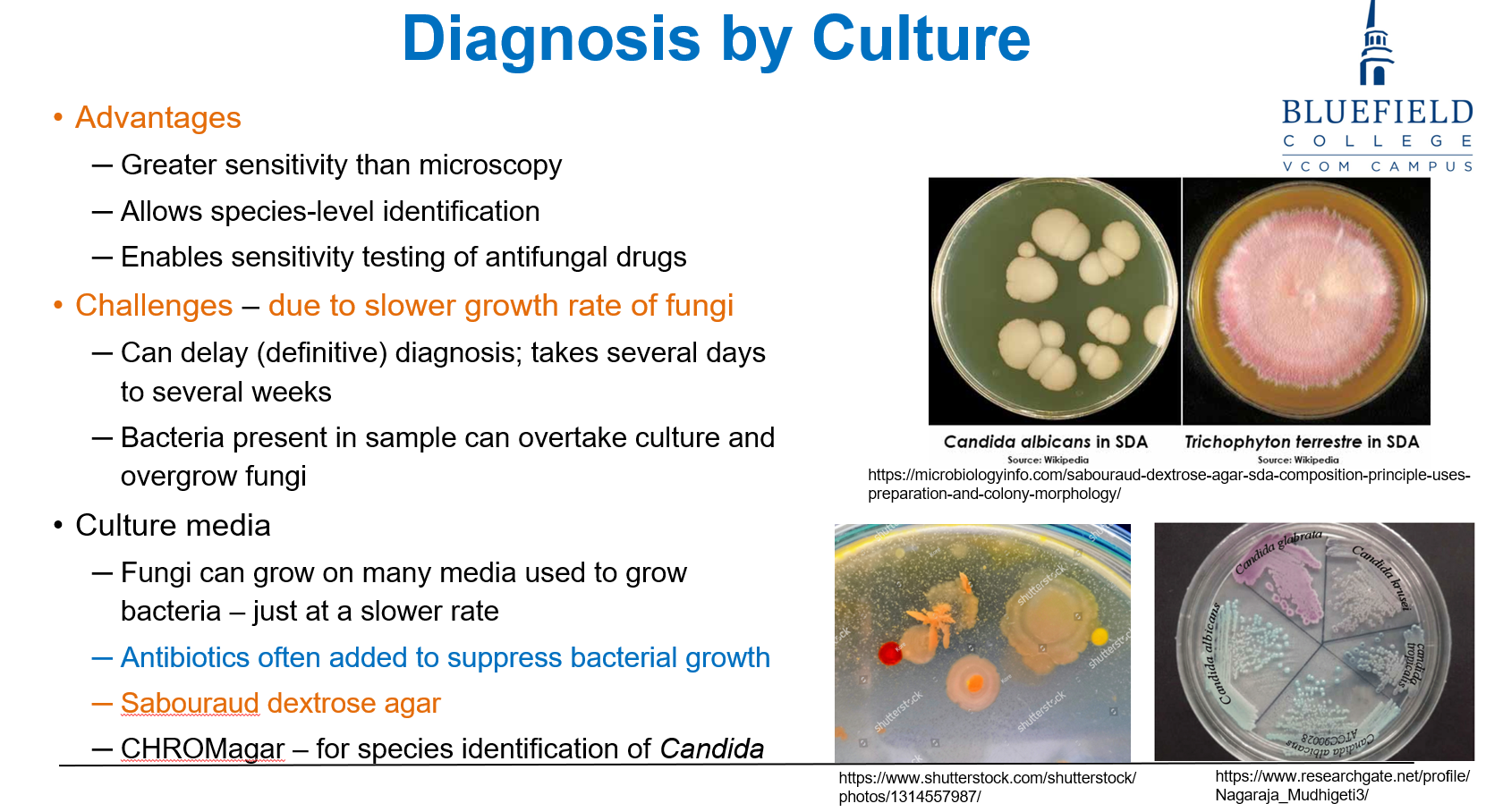 <p>D. Differentiates fungal species based on colony color<br></p><p><strong>CHROMagar</strong> is a <strong>differential medium</strong> that allows <strong>species-level identification</strong> of <strong>Candida</strong> by colony <strong>color</strong> differences. It improves diagnostic precision over standard media.</p>