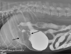 <p>What is wrong with this patient's stomach? This is an abnormal finding on a gastrogram</p>