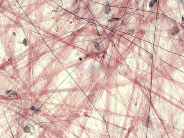 <p>1. support and binding of other tissues<br>2. holding body fluids<br>3. defending the body against infection<br>4. storing nutrients as fat</p>