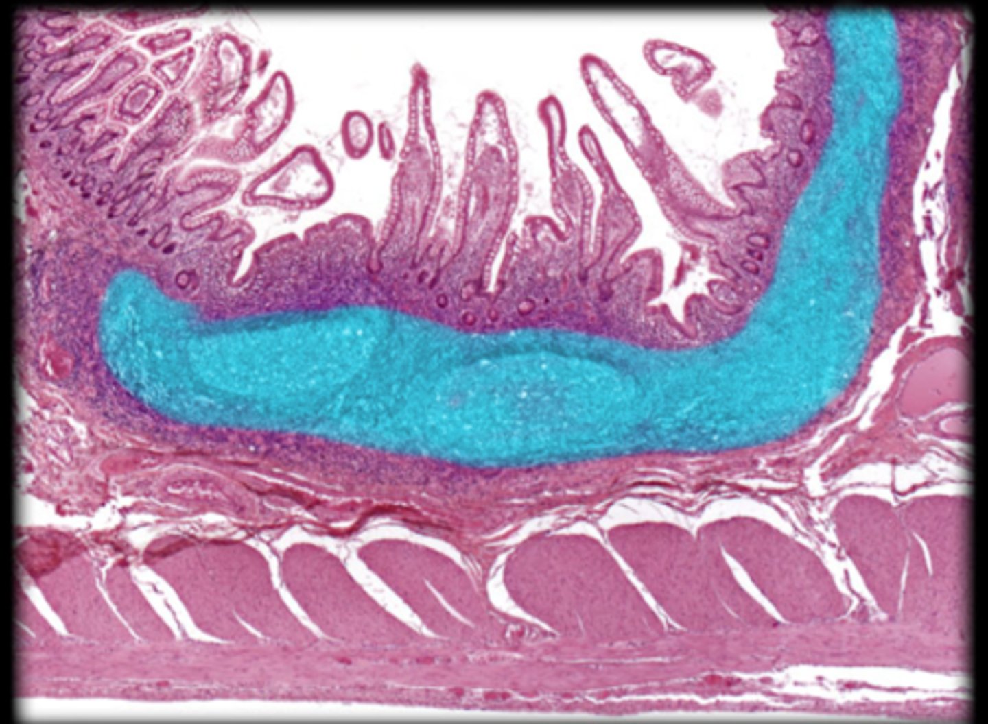 <p>Small intestine</p>