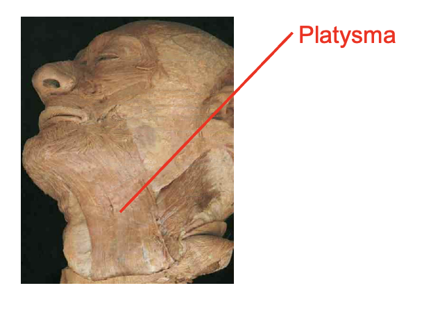 <ul><li><p>platysma</p></li></ul><p></p><p>origin</p><ul><li><p>fascia over upper chest</p></li></ul><p>insertion</p><ul><li><p>mandible</p></li></ul><p></p><img src="https://knowt-user-attachments.s3.amazonaws.com/0899fde9-47cf-4cb8-9c6c-a455d74cf66a.png" data-width="100%" data-align="center"><p></p>
