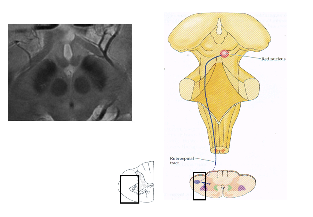 <ol><li><p>Rubrospinal</p></li><li><p>Corticospinal</p></li></ol><p></p>