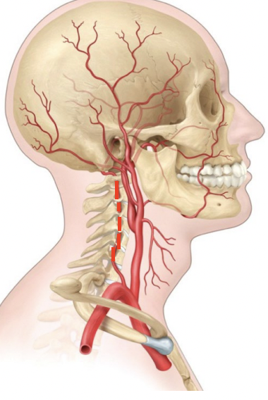 <p>An artery that travels through the transverse foramina of the cervical vertebrae and merges to form the basilar artery.</p>