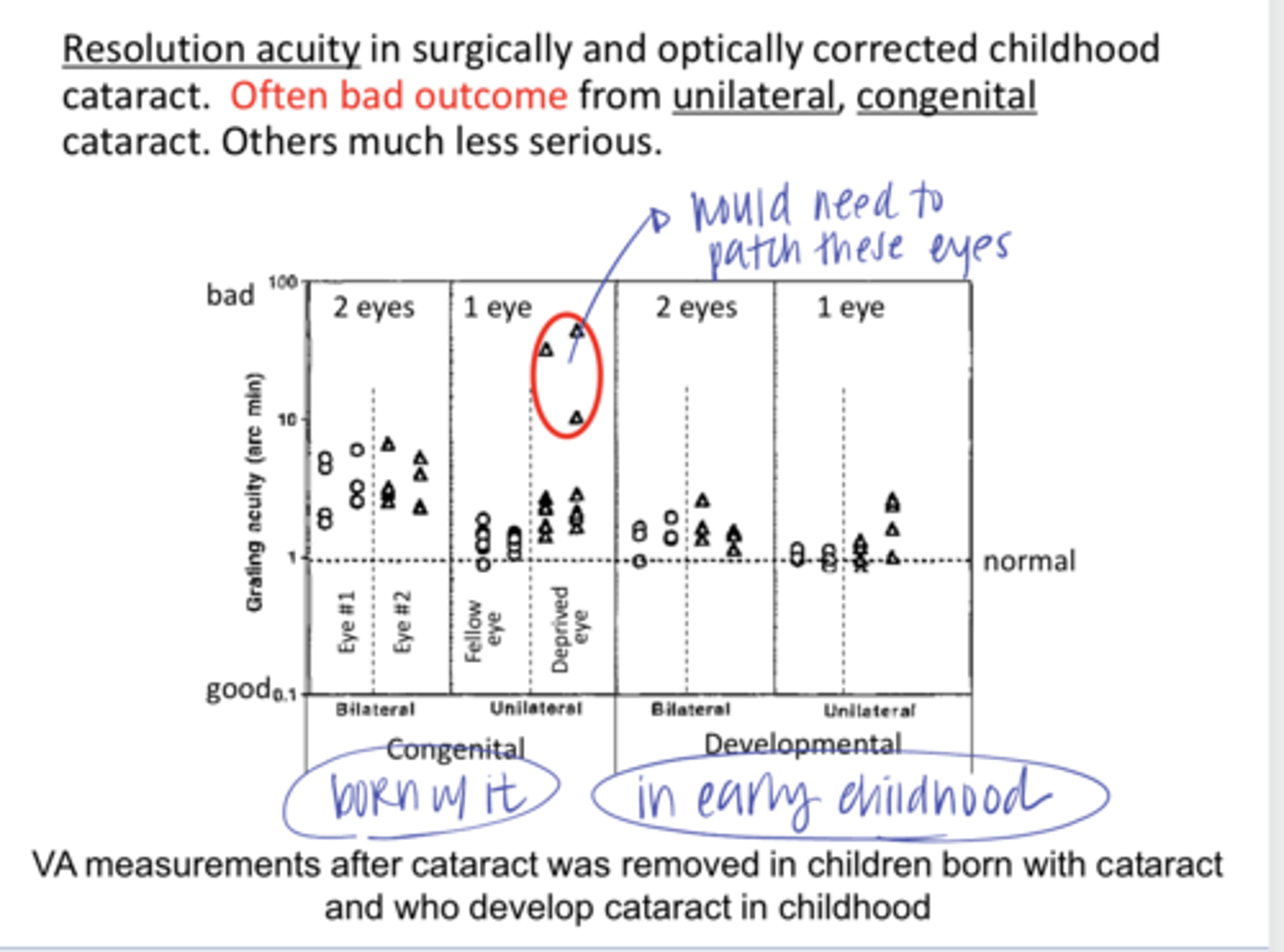 <p>True or False: </p><p>There is often a bad outcome from unilateral, congenital cataracts</p>