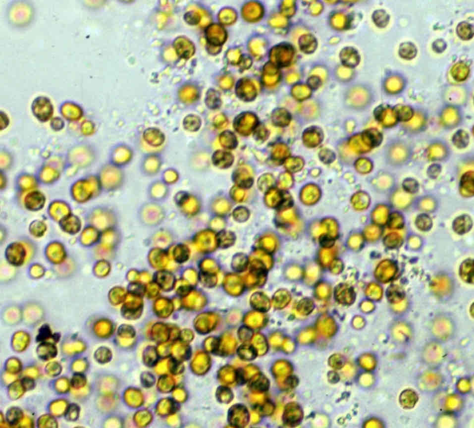 <p>Dinoflagellati simbionti di molti coralli ermatipici, essi perdono flagelli e assumono morfologia sferica </p>