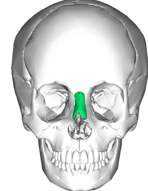 <p>What is the name of this bone in the skull?</p>