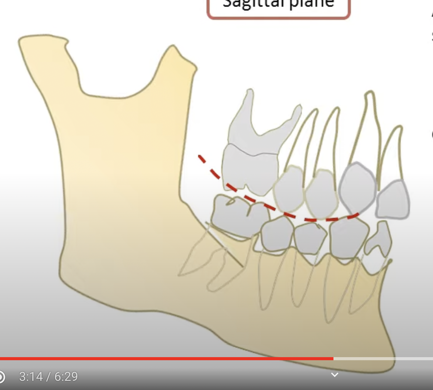 <ul><li><p><span style="font-family: PalatinoLinotype">Graf von Spee</span></p></li><li><p>From the occlusal surfaces of the teeth, starting at the tip of the mandibular canine and extending to the buccal cusp tip of the molars.</p></li><li><p>Sagittal relationship (anteroposterior-relationship line).</p></li><li><p>Established the occlusal alignment of the teeth as projected into the median plane.</p></li></ul><p></p>