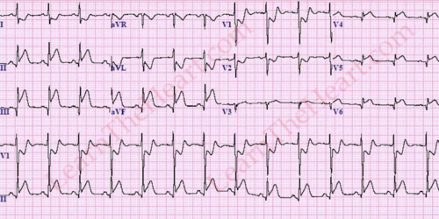 <p>What are the findings</p>