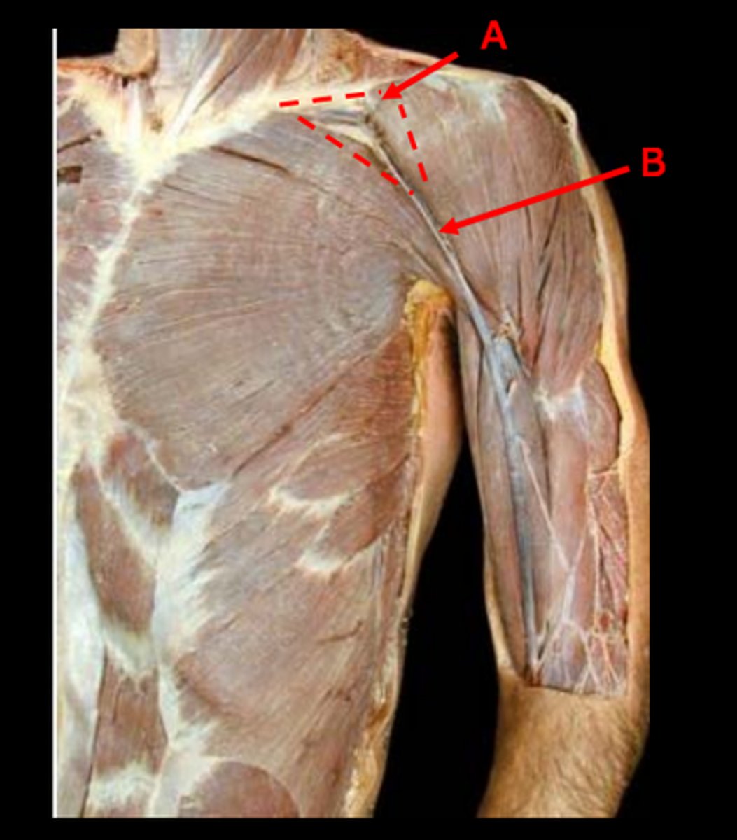 <p>point at which the cephalic vein dives to join the axillary vein</p>