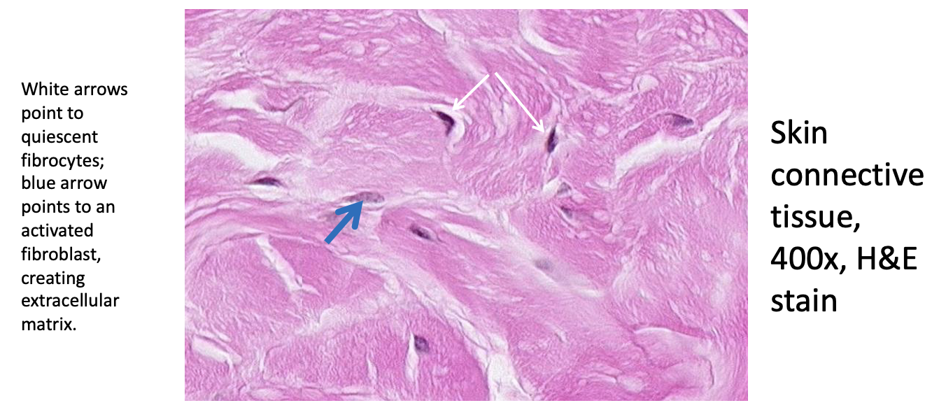 <p>True</p><ul><li><p><span>Most of these connective tissue cells (fibrocytes, black arrows) are quiescent, not actively producing connective tissue proteins and their nuclei contain a high proportion of heterochromatin.&nbsp; If there is a wound, these cells can “wake up” and start producing the extracellular proteins that strengthen the tissue.&nbsp; When this happens the chromatin unravels to increase the amount of euchromatin (fibroblasts, blue arrow).</span></p></li></ul><p></p>