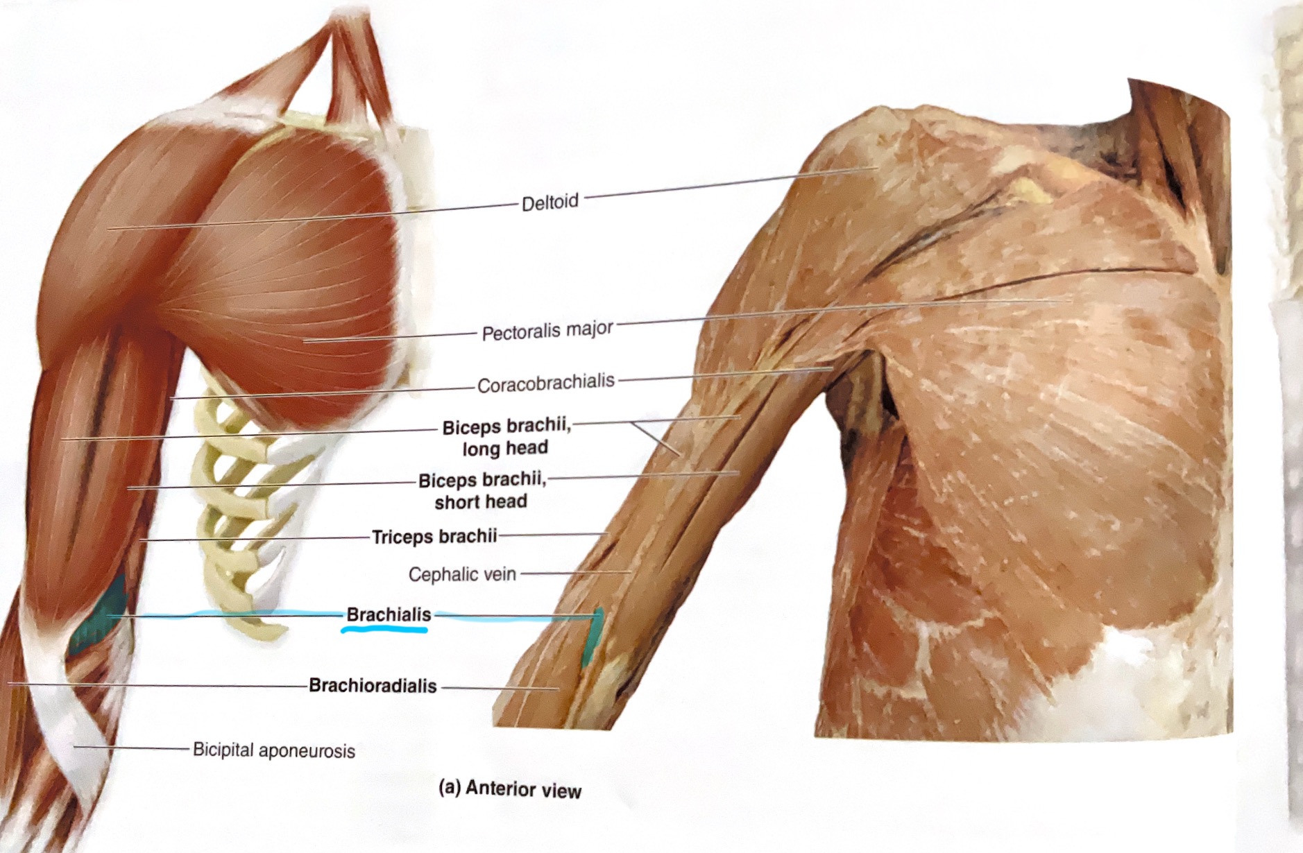 <p>Origin: Anterior diaphysis of humerus</p><p>Insertion: Ulnar tuberosity and coronoid process of ulna</p><p>Action: Flex elbow</p>
