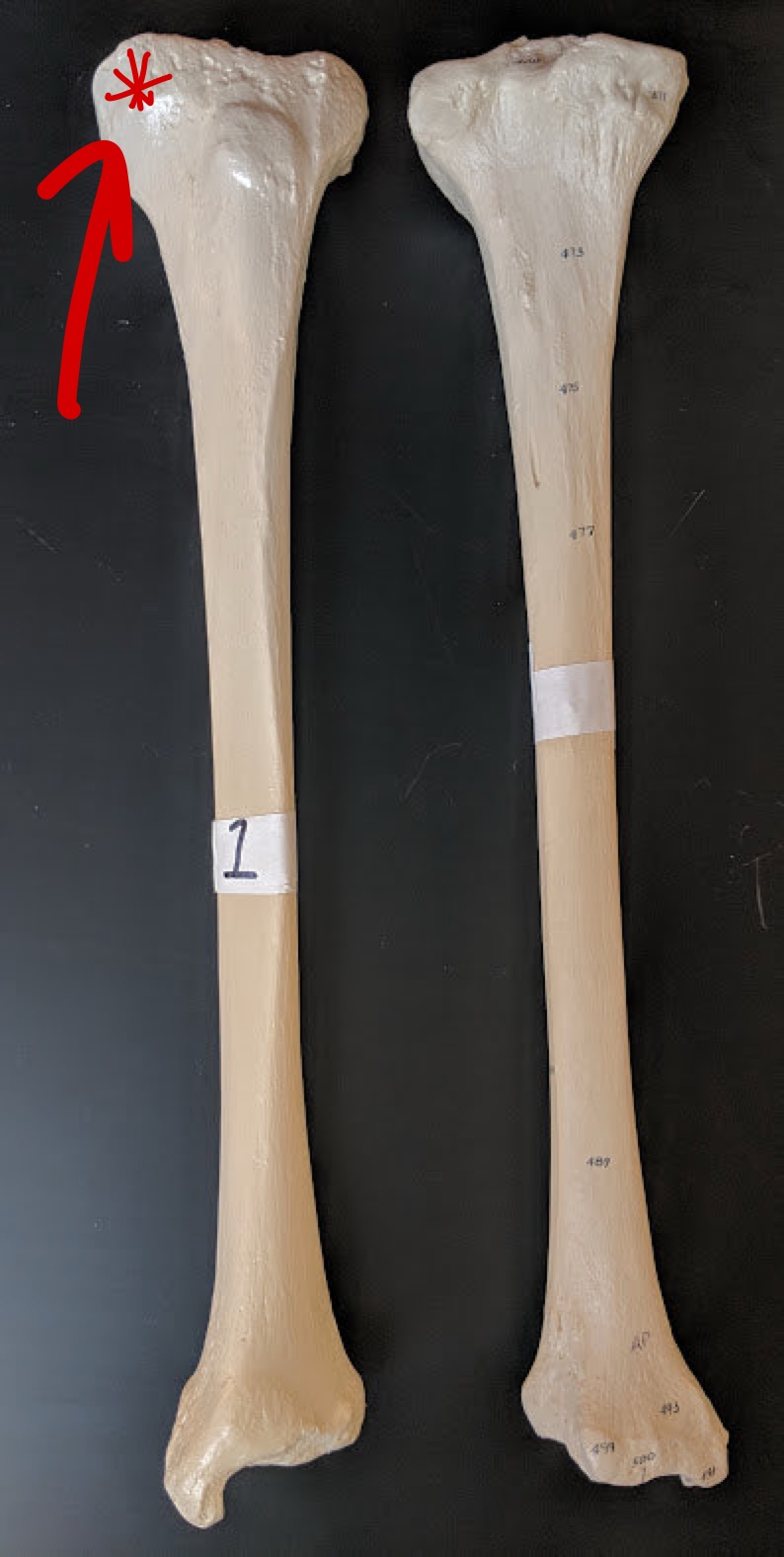 <p>Name this structure</p>