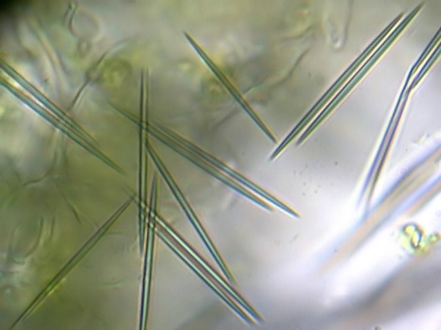 <p>What plant crystals are shown below?</p>