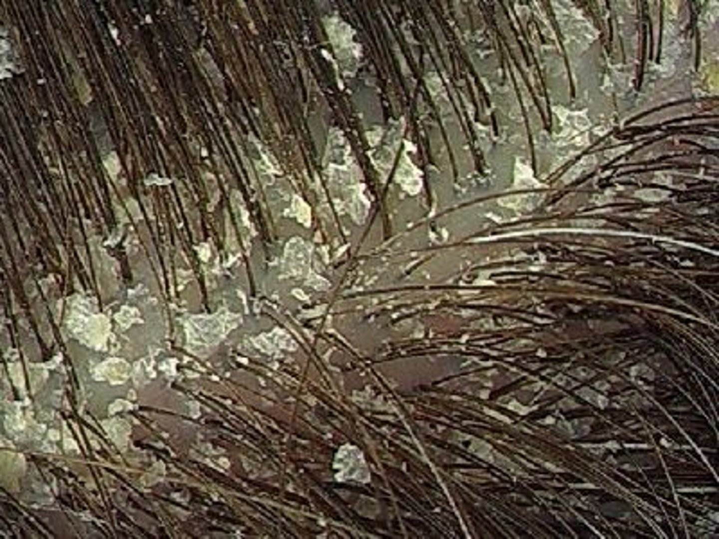 <p>Thin flake of dead exfoliated epidermis</p>