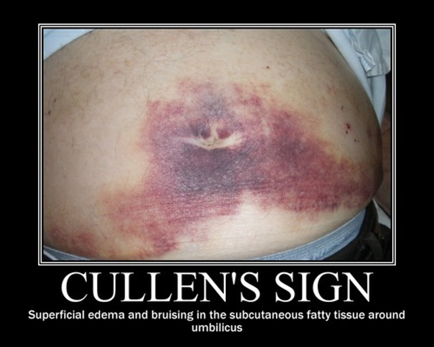 <p>cullens sign</p>