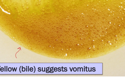 <p><span style="background-color: transparent;"><strong><span>Vomiting</span></strong></span></p>