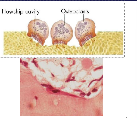 <ol><li><p>Osteoblasts</p><ul><li><p>derived from mesenchymal stem cells</p></li><li><p>synthesise and secrete osteoid</p></li><li><p>active in mineralisation process</p></li></ul></li><li><p>Osteocytes </p></li></ol><ul><li><p>scattered within the matrix</p></li><li><p>interconnected by dendritic processes</p></li><li><p>derived from osteoblasts but stopped synthesis of matrix and dividing</p></li><li><p>reside within ‘lacunae’ which are interconnected by ‘canaliculi</p></li><li><p>long-lived</p></li><li><p>maintain the matrix</p></li></ul><ol start="3"><li><p>Osteoclasts</p></li></ol><ul><li><p>responsible for bone resorption</p></li><li><p>large, multinuclei cells</p></li><li><p>release protons, leads to an acid environment, leads to demineralisation</p></li><li><p>secrete proteases that destroy the organic matrix</p></li><li><p>derived from bone marrow</p></li></ul><p></p>