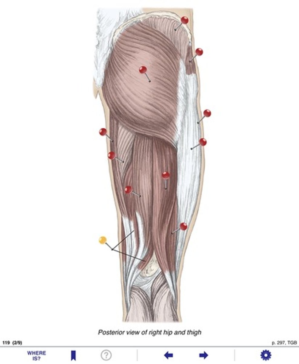 <p>Name the muscle at the yellow pin</p>