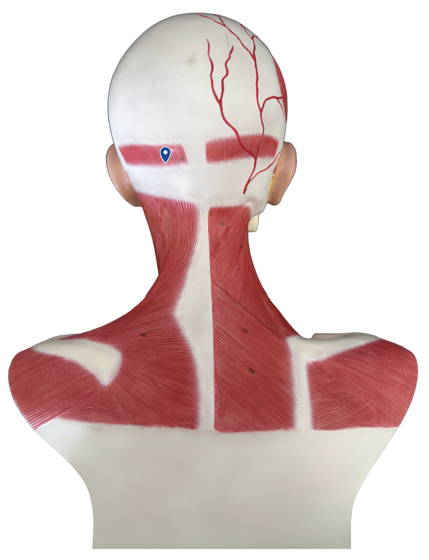 <p>What muscle is the arrow pointing to?</p>