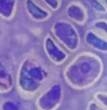 <ul><li><p>Found in cartilage</p></li><li><p>﻿﻿Reside in spaces called lacunae</p></li></ul>