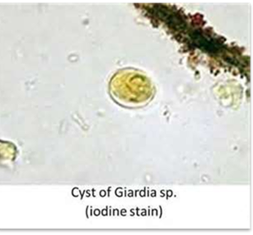 <p>Giardia species</p>