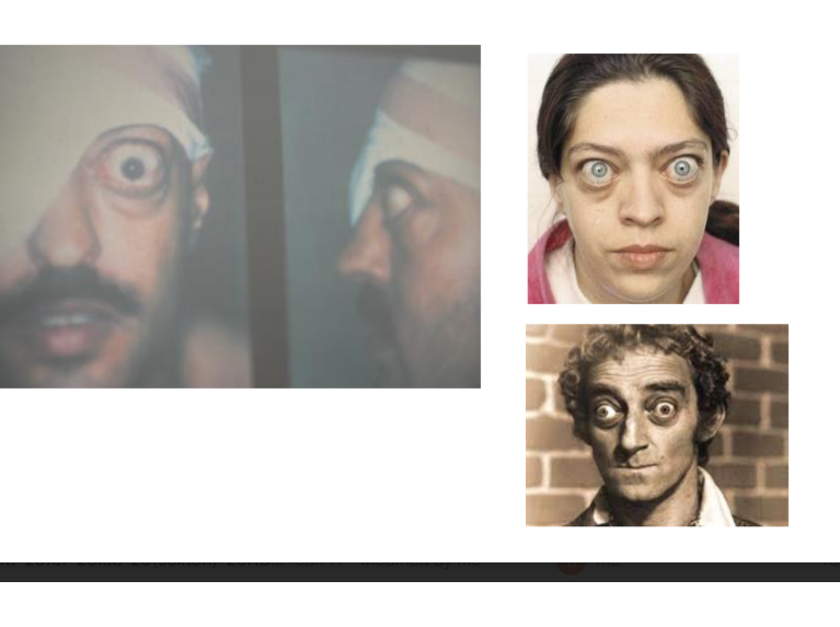 term image