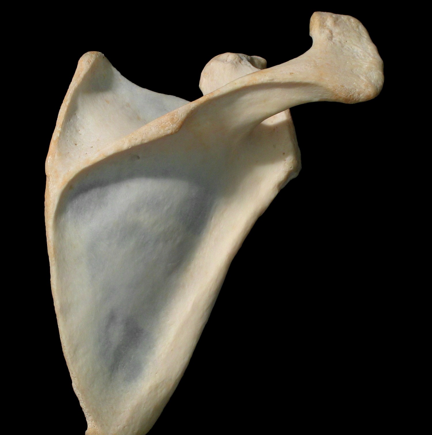 <p>Is this the anterior or posterior aspect of the scapula?</p>