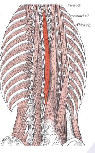 <p>Muscle of vertebral column</p>