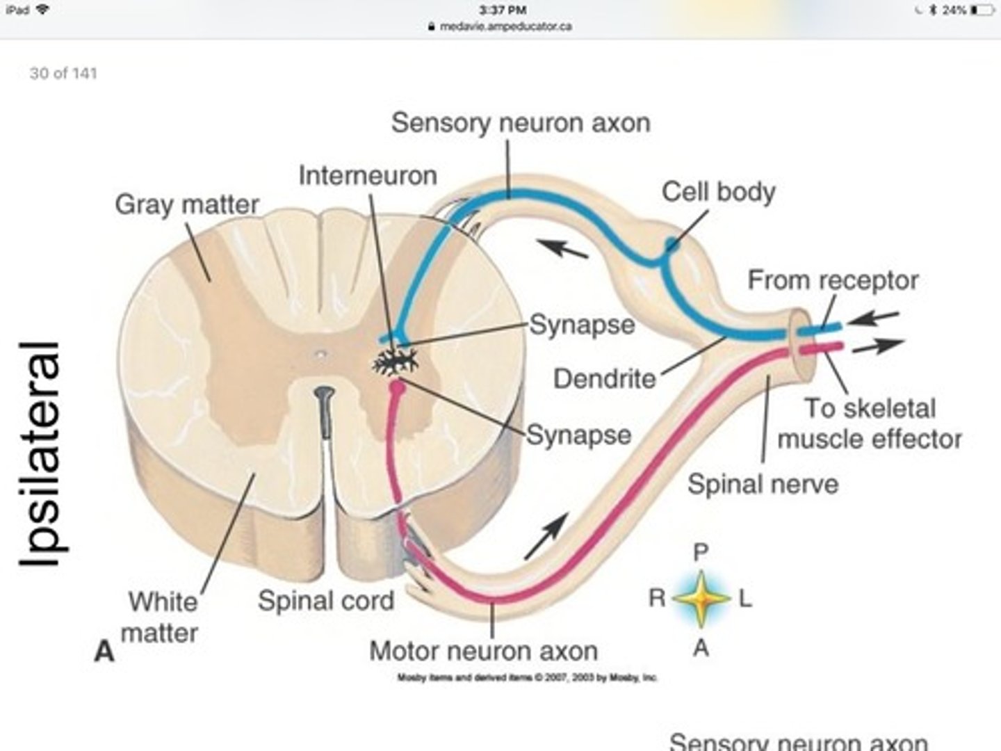 <p>one in which the sensory input and the motor output are on the same sides of the spinal cord</p><p>Ex. flexor reflex</p>