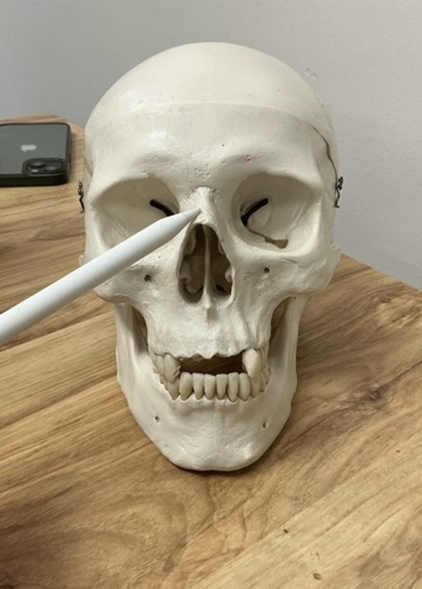 <p>What bone is this?</p>