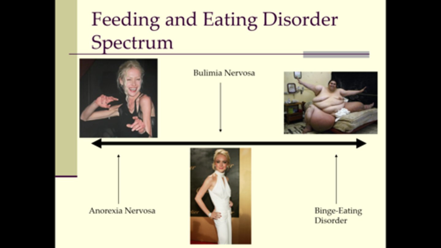<p>serious illnesses marked by severe disturbances in a person's eating behaviors that significantly impair physical health or psychological functioning</p>