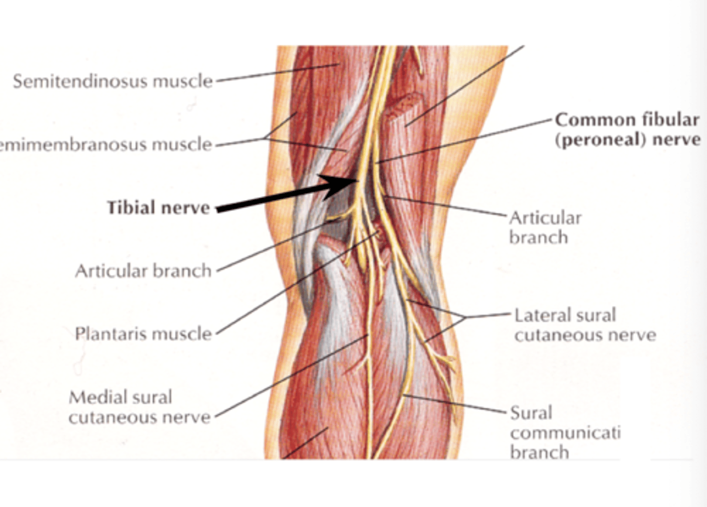 <p>INFERIORLY through the middle of the popliteal fossa</p><p>superficial to popliteal vein and artery</p>