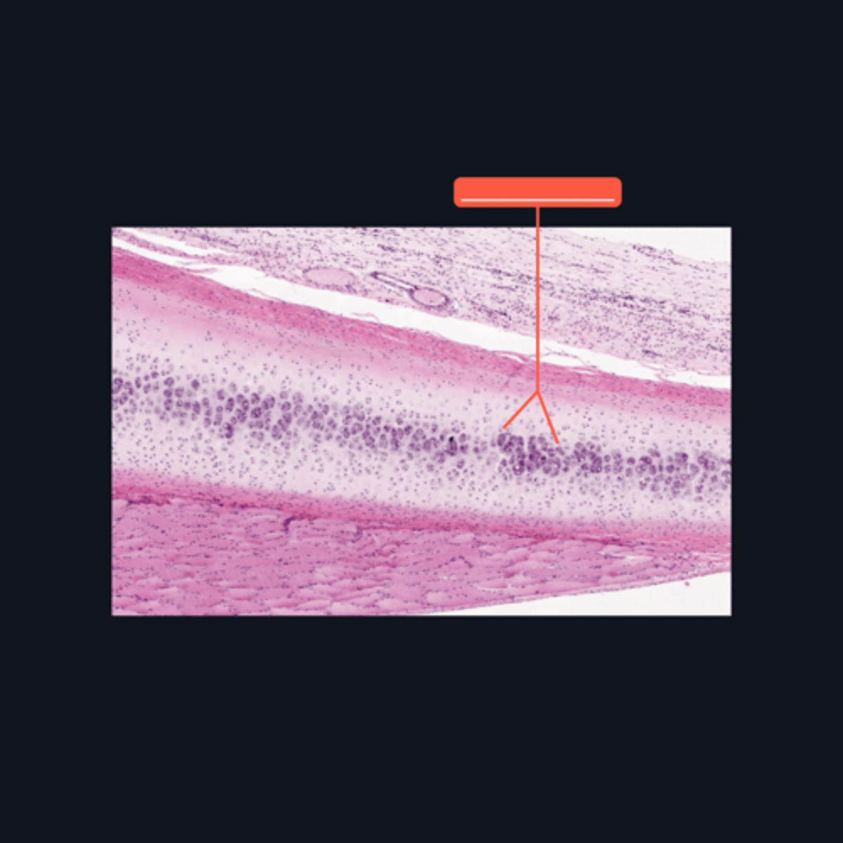 <p>The chondrocytes in the central area of the cartilage form clusters, which are sometimes referred to as ________?</p>