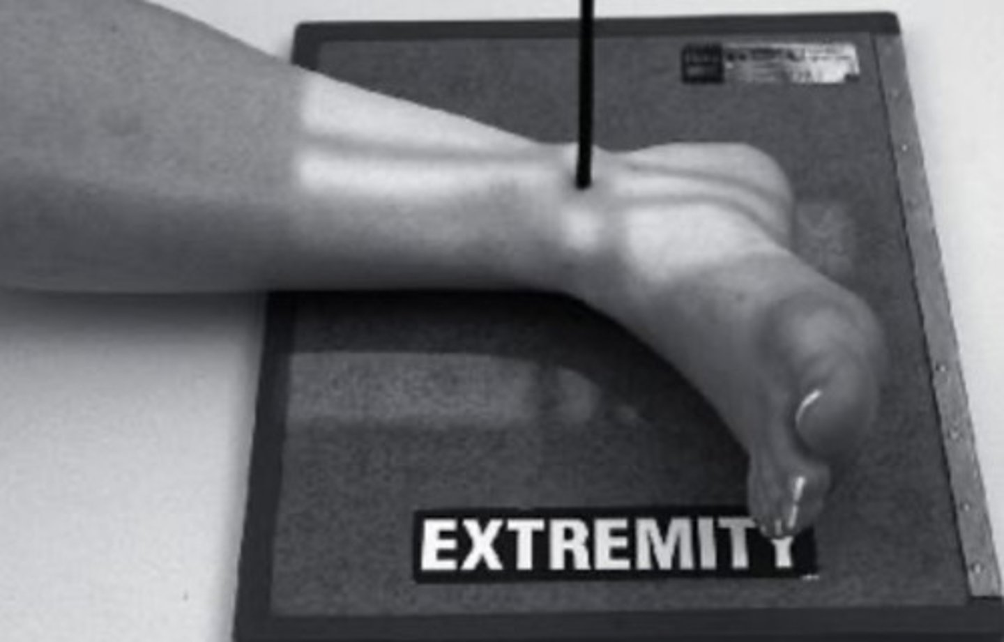 <p>lateral ankle</p><p>3 multiple choice options</p>