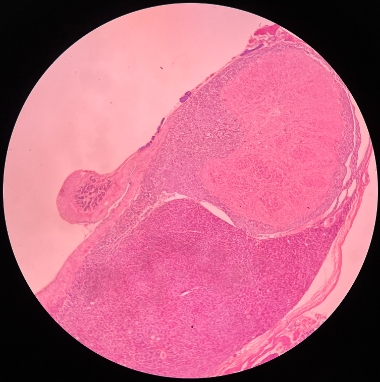 • Located inferior to the hypothalamus and connected to it by the infundibulum.

• Composed of independent anterior and posterior lobes.

• Also known as the pituitary gland.