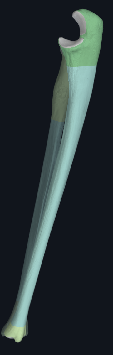 <p>Olecranon Process</p><p>Trochlear (semilunar) Notch</p><p>Styloid Process</p><p>Coronoid Process</p><p>Radial Notch of Ulna</p><p>Head of Ulna</p><p>Ulnar Tuberosity</p>