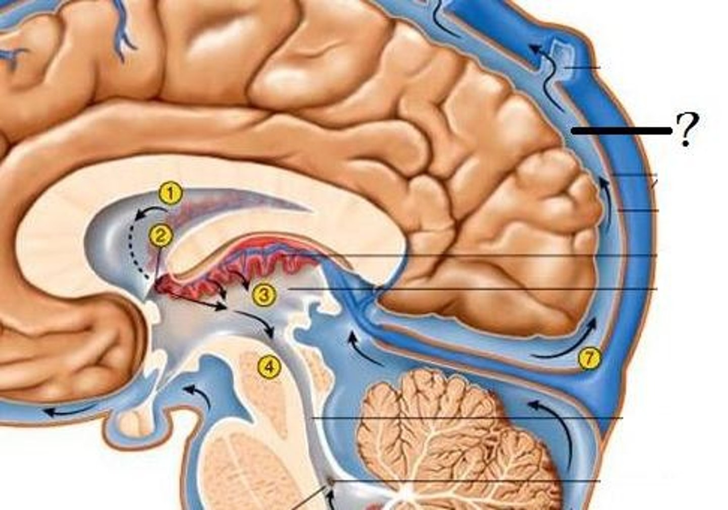 <p>filled with CSF; contains major arteries of the brain</p><p>exists independently of pathology (meaning we have this space even if we are healthy)</p>