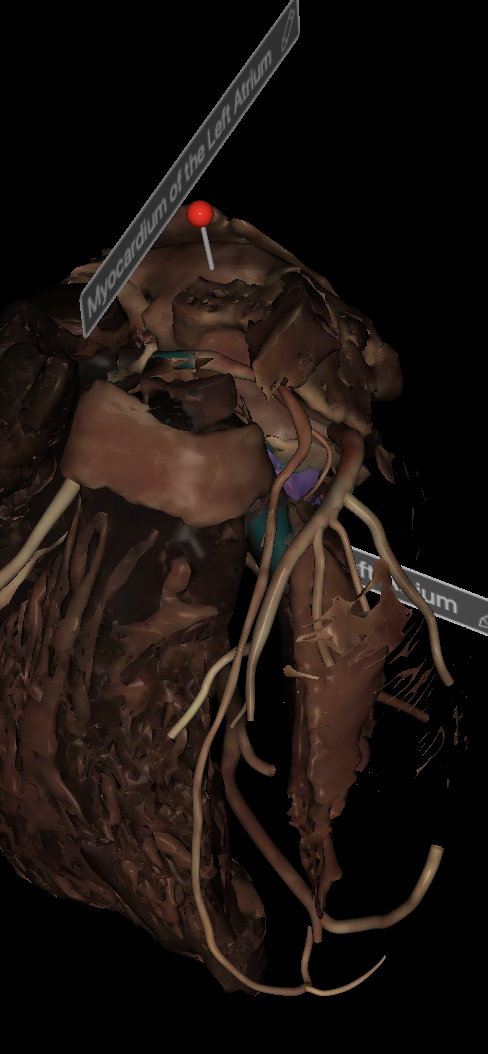 <p>Name the structure highlighted </p>