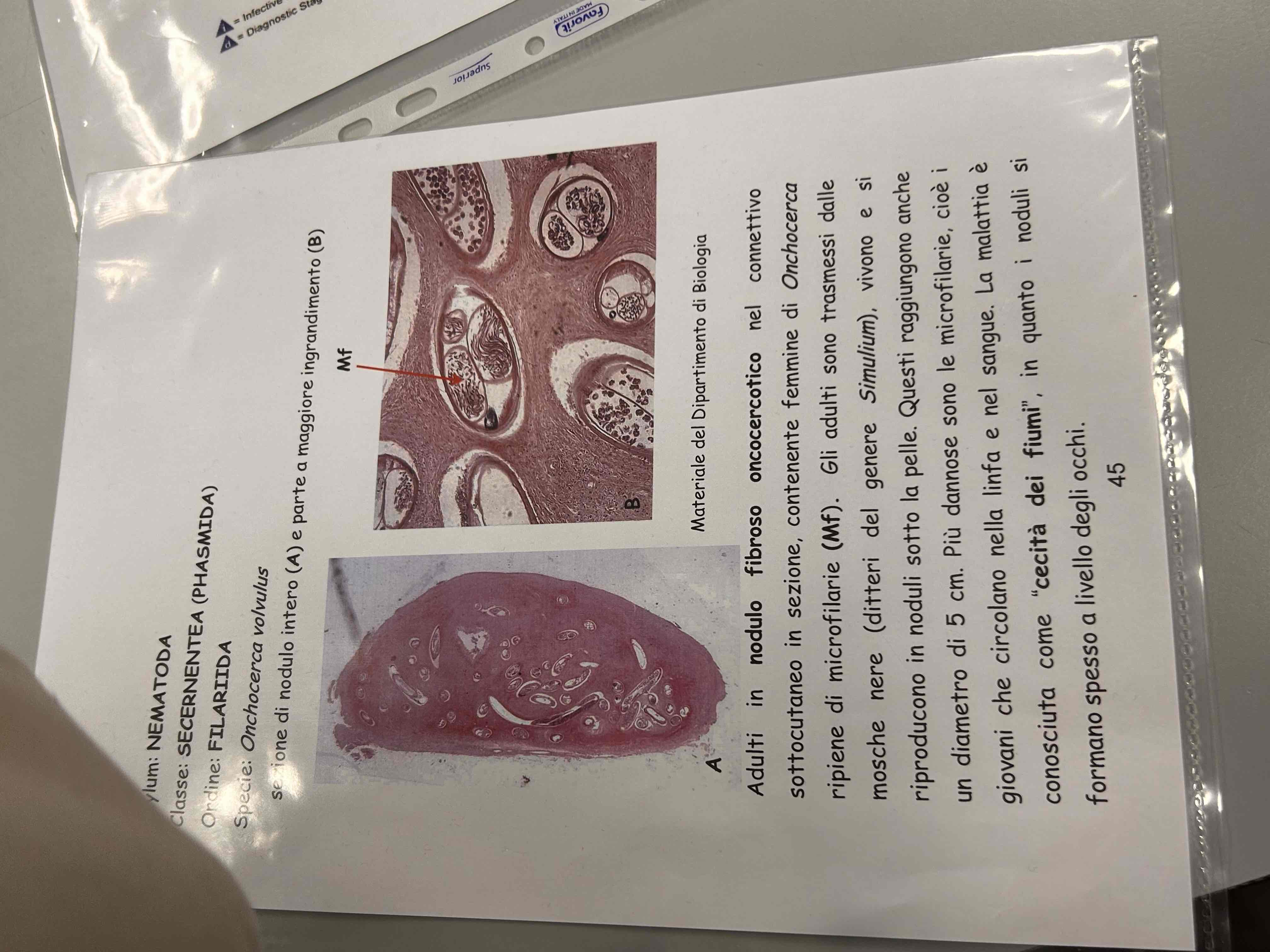 <p>Onchocerca volvulus (sezione)</p>