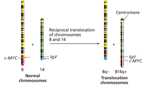 <p>B-cell (antibody-producing cells) malignancy</p><ul><li><p>translocation = 8q11 to 14q32, or 2p11 to 22q11</p></li></ul><p></p>