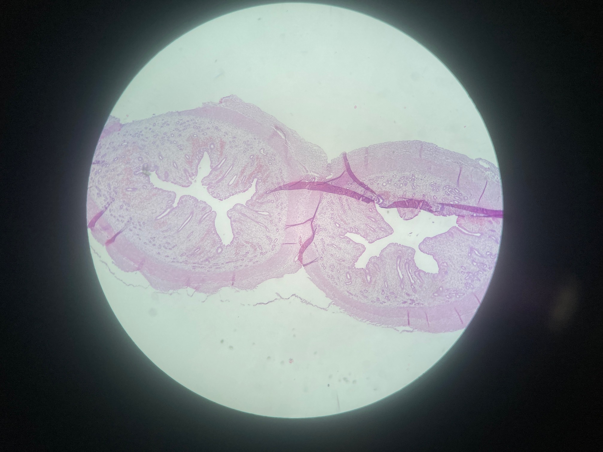 <p>Uterus (dog)</p><p><span>Endometrial epithelial cells</span></p><p><span>Endometrial stromal cells</span></p><p><span>Myometrial smooth muscle cells</span></p><p><span>Perimetrial cells</span></p><p><span>Uterine glandular cells</span></p>